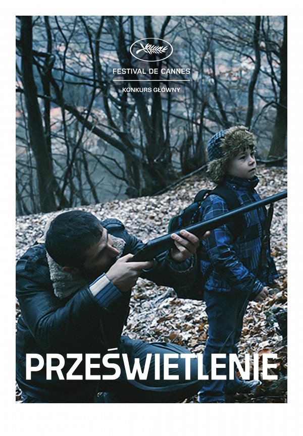 Prześwietlenie